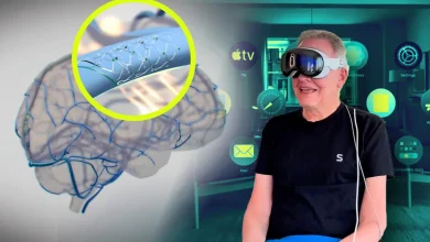 wtf synchron brain implant alexa apple vision pro site Detafour
