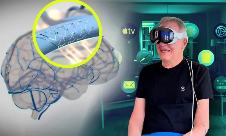 أبل وسينكرون تطوران تقنيات للتحكم في الأجهزة عبر رقائق دماغية 1 wtf synchron brain implant alexa apple vision pro site Detafour